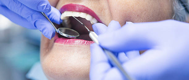 Best Emergency Dental Care for Sports Injuries in Ephrata, WA